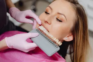Dentes com tonalidade natural antes do clareamento
